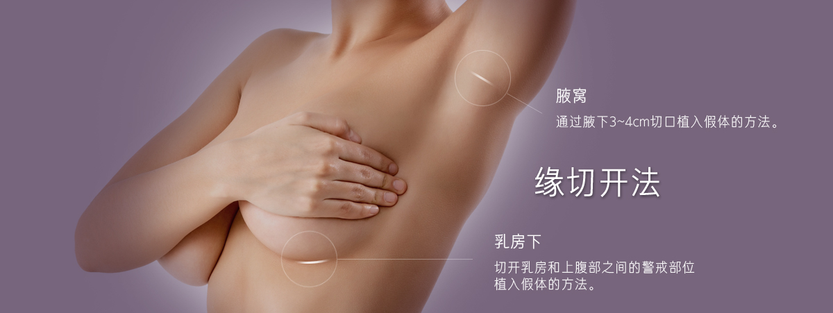 缘切开法:
	腋窝: 通过腋下3~4cm切口植入假体的方法。
	乳房下: 切开乳房和上腹部之间的警戒部位植入假体的方法。