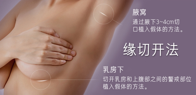 缘切开法:
	腋窝: 通过腋下3~4cm切口植入假体的方法。
	乳房下: 切开乳房和上腹部之间的警戒部位植入假体的方法。
